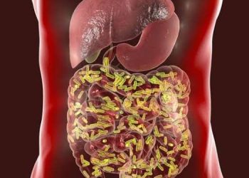 Berikut Ini Cara Ampuh Mengatasi Peradangan Usus Besar pada Orang Dewasa