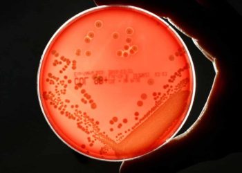 Bakteri Super Ini Ancam Ekonomi Global, Berpotensi Rugikan Rp34.000 Triliun per Tahun pada 2050