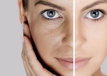 Facial Di Rumah Menggunakan Batu Es