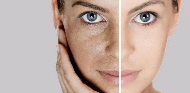 Facial Di Rumah Menggunakan Batu Es