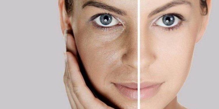 Facial Di Rumah Menggunakan Batu Es
