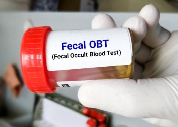 Mengenal Occult Bleeding, Pendarahan Tersembunyi yang Sering Tak Disadari